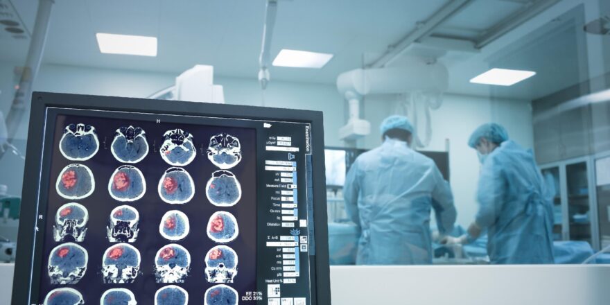 BrainTumors_share
